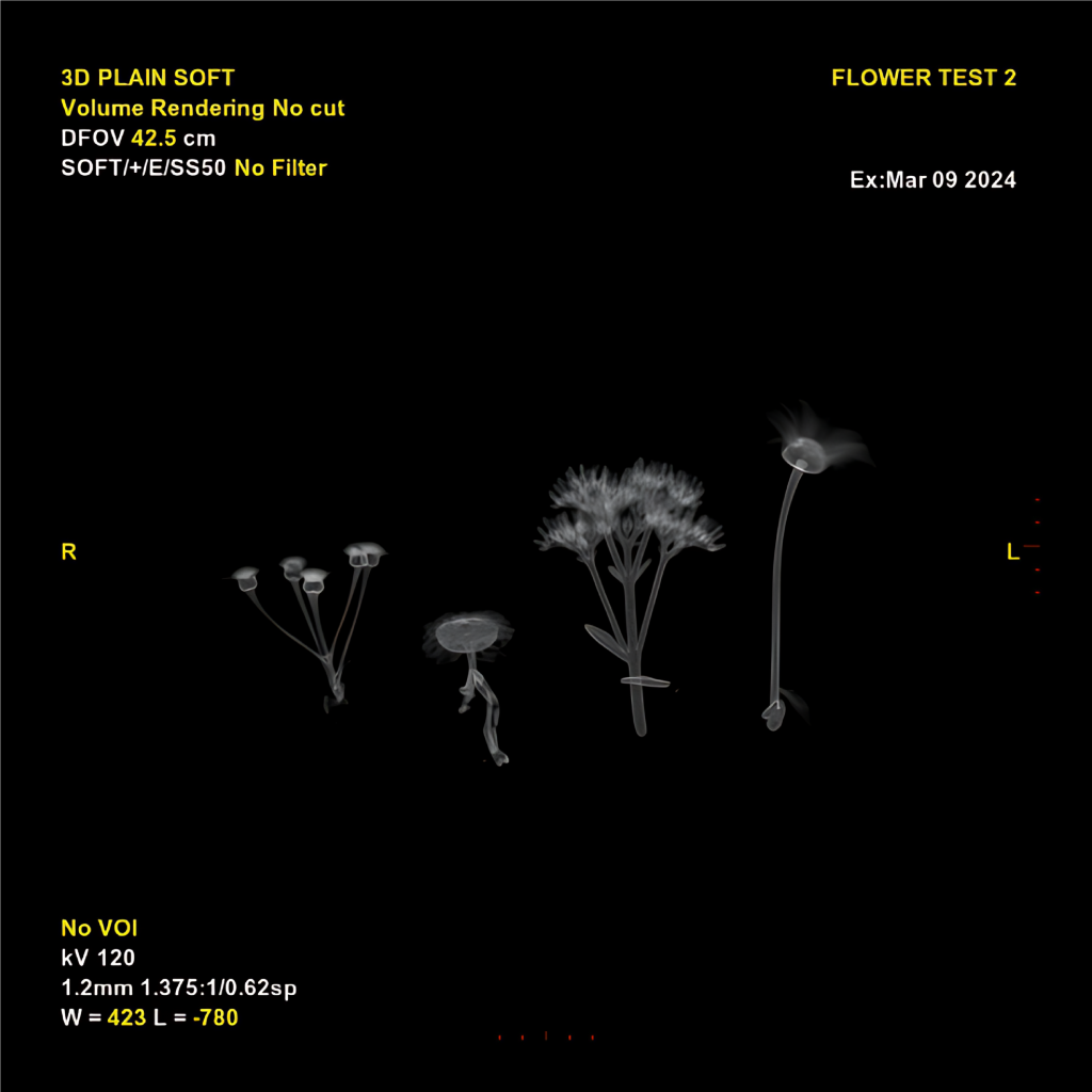 ‘Beneath The Surface of Beauty’ - The radiology reveals plants’ inner architecture, stripping away colour to expose unseen structures. (Image Courtesy: Kaanchi Chopra)